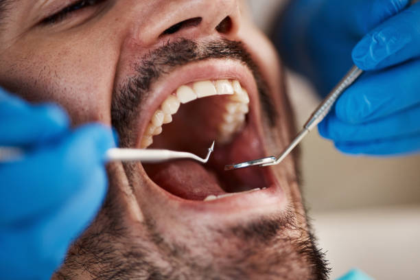 Best Broken or Chipped Tooth Repair in Trainer, PA